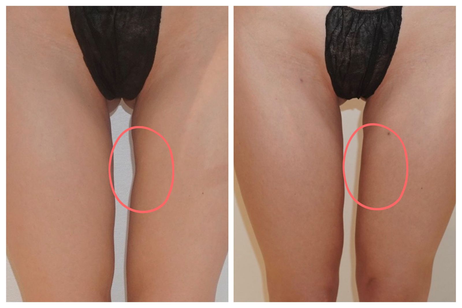 Alloclae: Az átalakulás titka és eredmények!