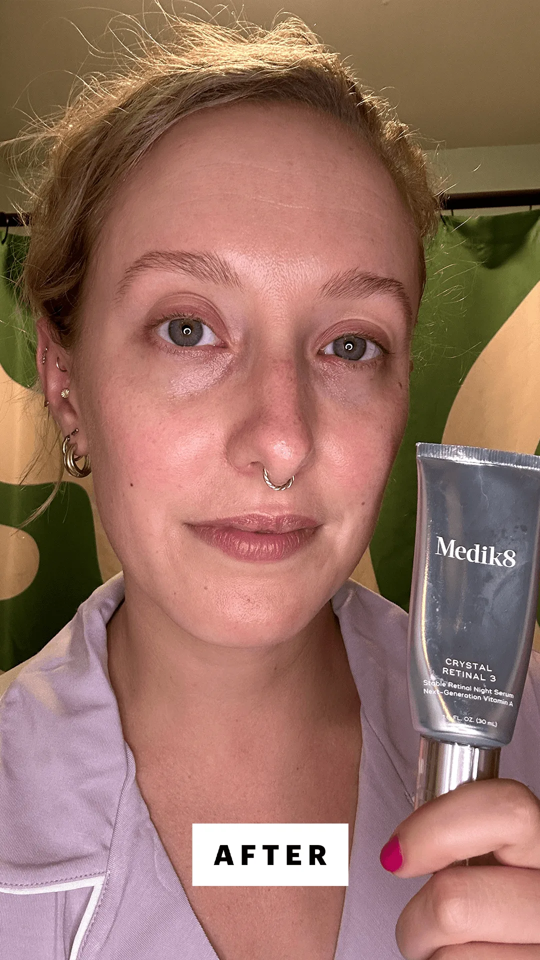 Medik8: 7 Legjobb Termék Minden Bőrtípusra és Problémára!