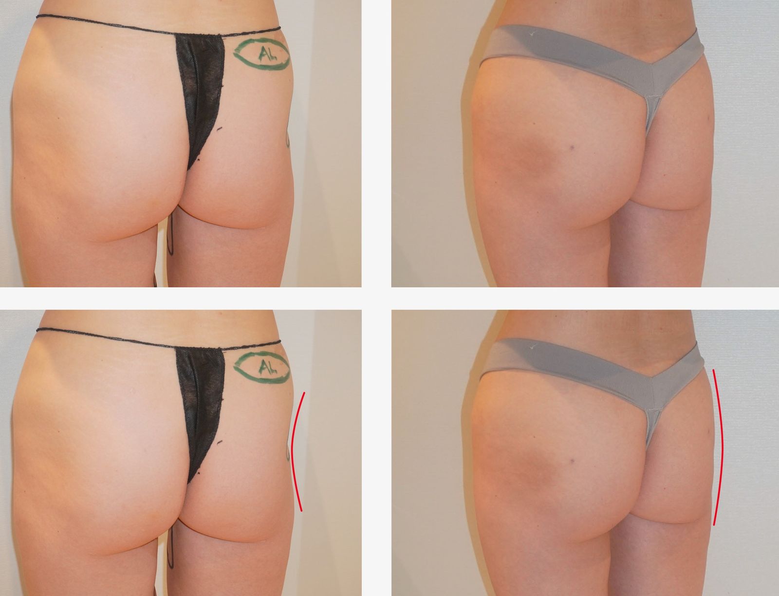 Alloclae: Az átalakulás titka és eredmények!