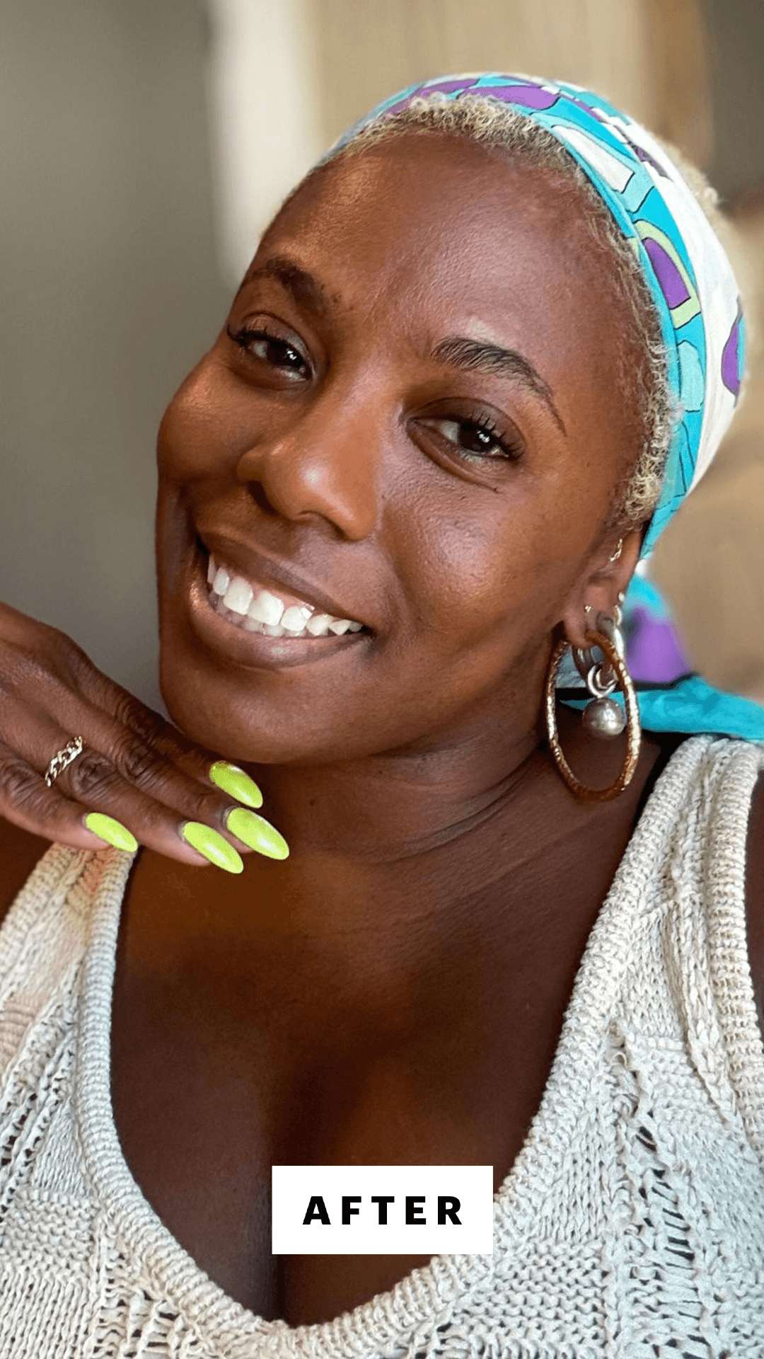 Legjobb alapozók érett bőrre: simítsd, ragyogtasd, tartósan!